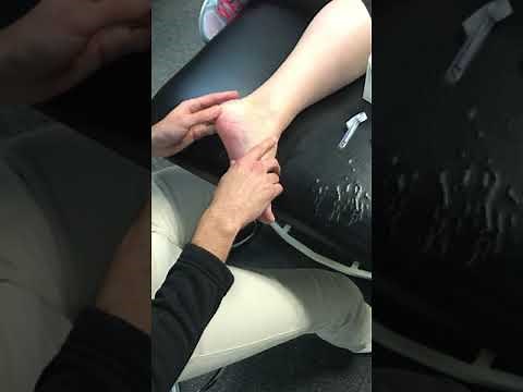 Dry Needling for Plantar Fasciitis