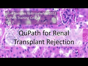 Practical applications of multiplex analysis in QuPath