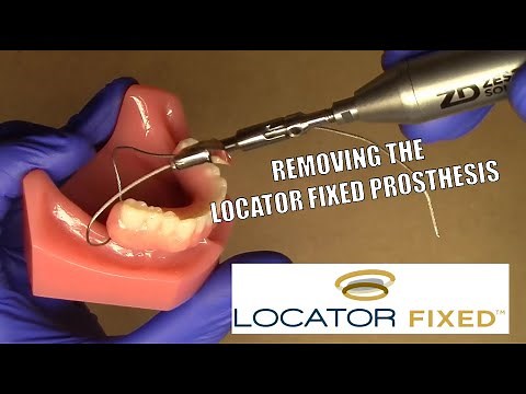 LOCATOR FIXED - Removal of the Prosthesis & Clinical Techniques