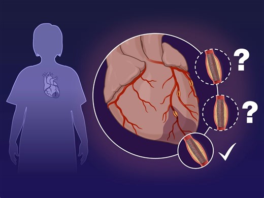 20K views · 136 reactions | For patients with STEMI and multivessel disease, the benefit of fractional flow reserve–guided complete revascularization, as compared with culprit-lesion-only PCI, is unclear. Research findings are summarized in a new Quick Take video. https://nej.md/3xj5b7u | The New England Journal of Medicine | Facebook