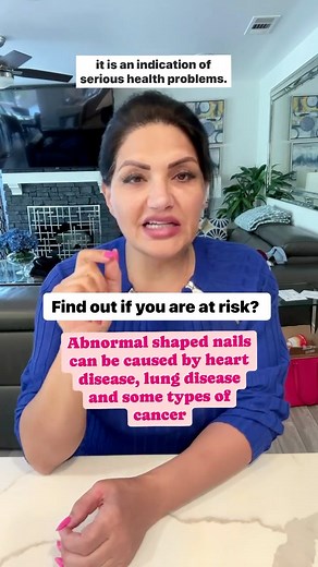 #foryourpage #fyp #fypシ゚viralシfypシ゚ #healthtips #pharmacist #howto | Angela Pharmd