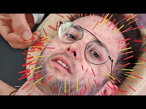 Zach Tries 1000 Needle Acupuncture