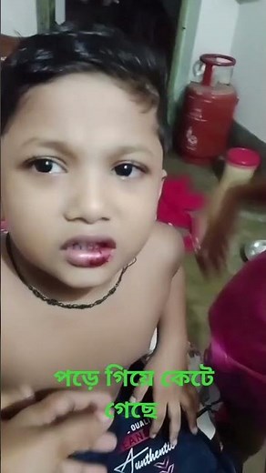 পড়ে গিয়ে কেটে গেছে##