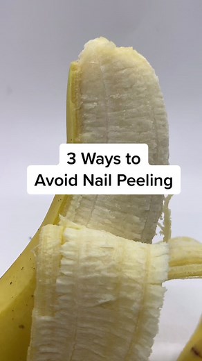 How to Prevent Nail Splitting: 3 Essential Tips