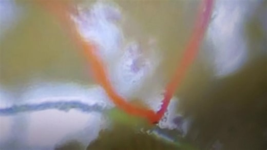 Ivermectin 1.0, 48 hrs! UP CLOSE!! | John Kaness