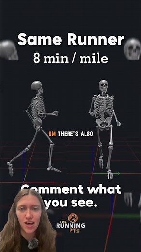 3D Gait Analysis Breakdown - Forefoot Striker with Excessive Vertical Oscillation