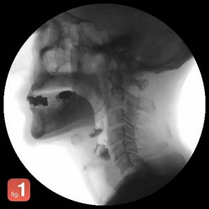 142K views · 754 reactions | Figure 1 es una app esencial para médicos. | Figure 1 | Facebook