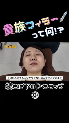 What is [Kizoku Filler]? ③ #Hyaluronic acid #Laugh lines