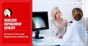 Shoulder Impingement Surgery Recovery Time - Cellaxys