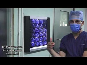 Live Root Repair (Rootfix) and Centralization by Dr Prathmesh Jain. Advance Hospitals