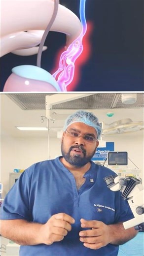 Varicocele Microsurgery vs. Embolization: Kaunsa hai behtar? (Part 1)