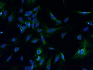 MEF - Mouse Embryonic Fibroblasts | Lonza