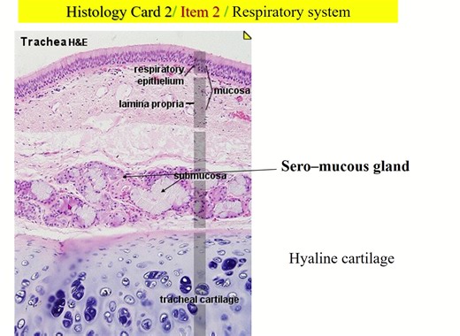 Histology of trachea #Respiratorysystem #histology #mbbs # | Easy human anatomy | Facebook