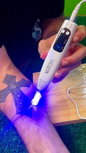 230K views · 673 reactions | Chinese engineers created a tattoo removal device you use at home!!!  | I am Barone | Facebook