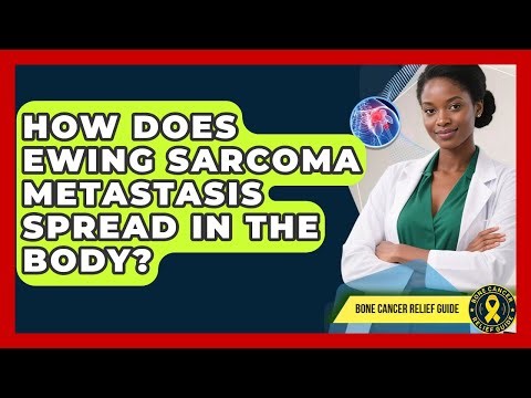 How Does Ewing Sarcoma Metastasis Spread In The Body? - Bone Cancer Relief Guide