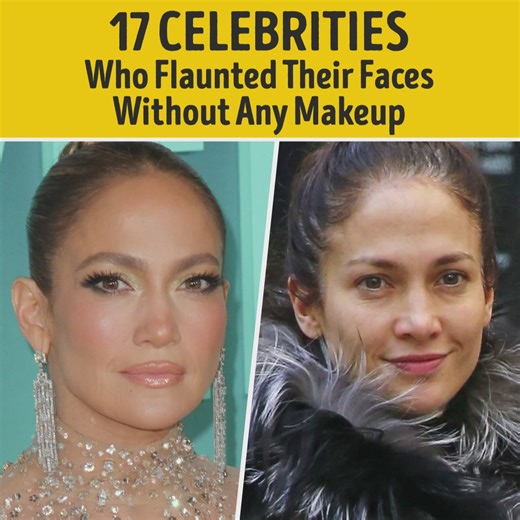 1.7M views · 10K reactions | 17 Celebrities Who Flaunted Their Faces Without Any Makeup | Bright Side | Facebook