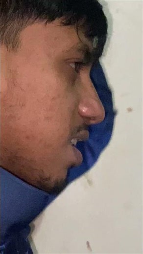 #dhakavsrongpur Dhakar junci kine Hotas 😤