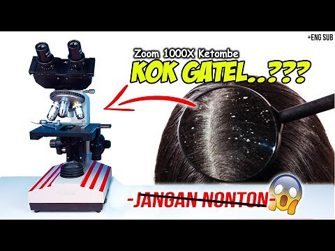 MAKHLUK HALUS DI KETOMBE KITA | Dundruff in Microscope Zoom 1000X