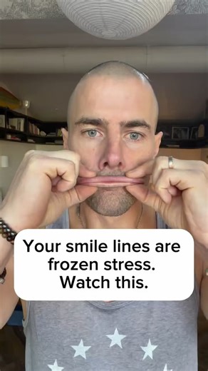 Those lines around your mouth? They’re not from age