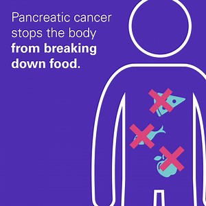 682 reactions · 337 shares | Half of people diagnosed with pancreatic cancer aren’t receiving a simple tablet that could literally stop them from starving. Join us to ask decision makers to change this. | Pancreatic Cancer UK | Facebook