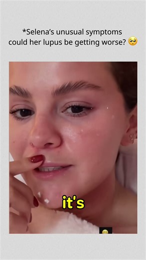 Selena’s unusual symptoms — could her lupus be getting worse? 🥺#SelenaGomez #BennyBlanco