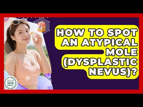 How To Spot An Atypical Mole (dysplastic Nevus)? - Healthy Skin Brief