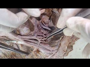 Internal iliac artery