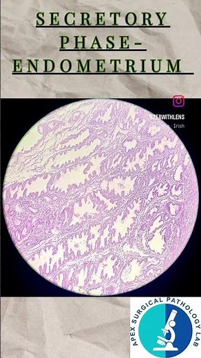 Here's a low-power view of endometrium in the secretory phase