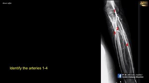 21 reactions · 15 shares | Identify the arteries in this angiogram of...