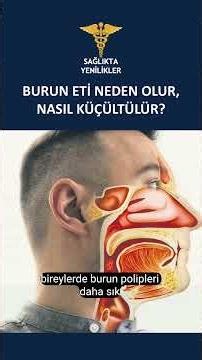What causes nasal polyps? How can they be reduced? #nasalpolyps #nasalpolypsreduction