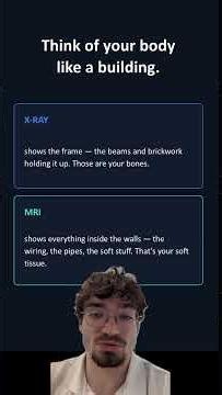 X-Ray vs MRI
