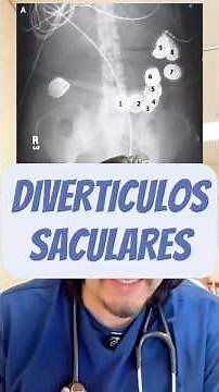 👜 The hidden pockets of the colon: saccular diverticula