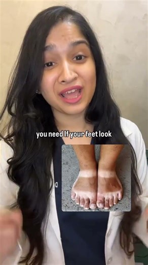 Product: Ga -12 Glycolic Acid Cream, ₹144 after discount (MRP 190)/ for 30gm!