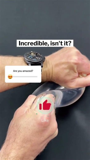 Silicone Breast Implant Rupture: What You Need to Know | Dr. Robert Morin