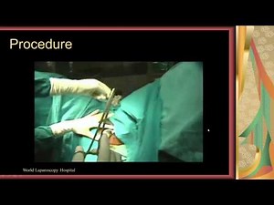 Master Class of Stapled Hemorrhoidopexy  • Video • MEDtube.net