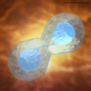 Affordable Stem Cell Therapy in Mexico