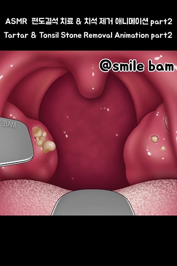 #틱톡뷰티 #애니메이션 #케어 #asmr #soonent #care #틱톡툰 #파트너크리에이터