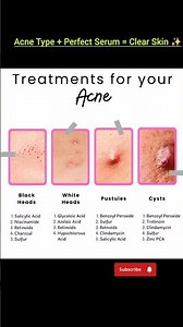 Treatments for your Acne ✨