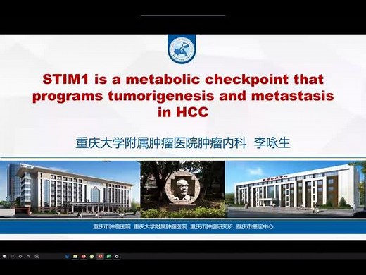 STIM1作为代谢检查点调控肝癌发生与转移