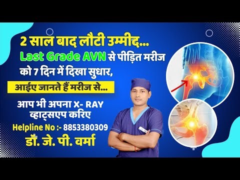 2 साल से पैर नहीं उठ रहा था | Last Grade AVN Patient को मिला आराम सिर्फ 7 दिन में | Real Case
