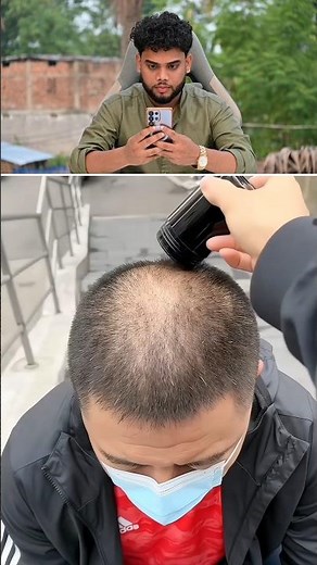 Real vs Fake Epitight Hair Confidence Kit #shorts