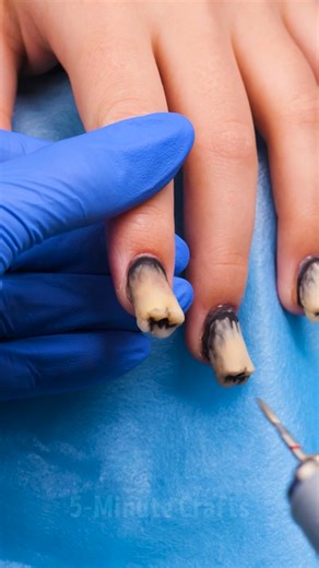 Tooth Nerve Removal 😱🦷 The Strangest Nail Trick Ever! | 5-Minute Crafts