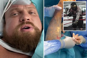 Eddie Hall confirms he suffered DETACHED BICEP as Thor fight delayed