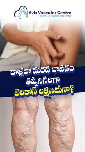 Is Leg Itching a Sign of Varicose Veins? Doctor Explains | Dr. Soujanya