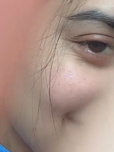 Close-Up Portrait of a Woman with Unique Features