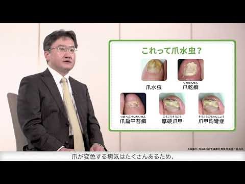 医師からのメッセージ 第１回 爪水虫とは