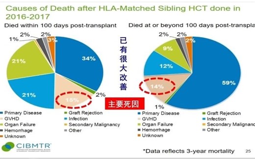GVHD诊治的研究进展