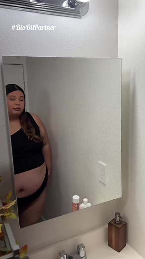 #biooilpartner Loving my body was a journey! Thank you @biooilusa for letting me share my story while using your amazing products🧡 #bodypositivitymonth #relatable #foru #plussize #plussizeedition