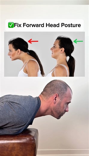 562K views · 3.4K reactions | Struggling with forward head posture or...
