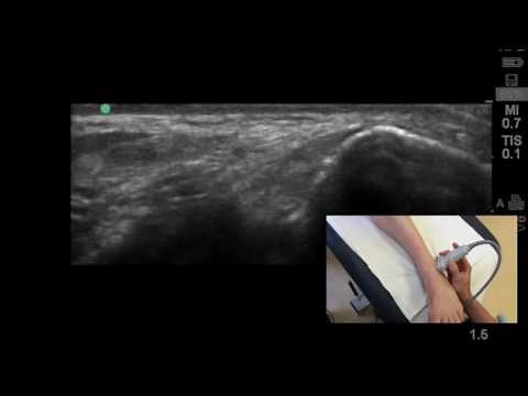 How to visualise the anterior talofibular ligament on ultrasound